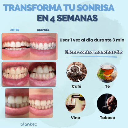 Blankea Dental Pro™ –  Gran God Tech